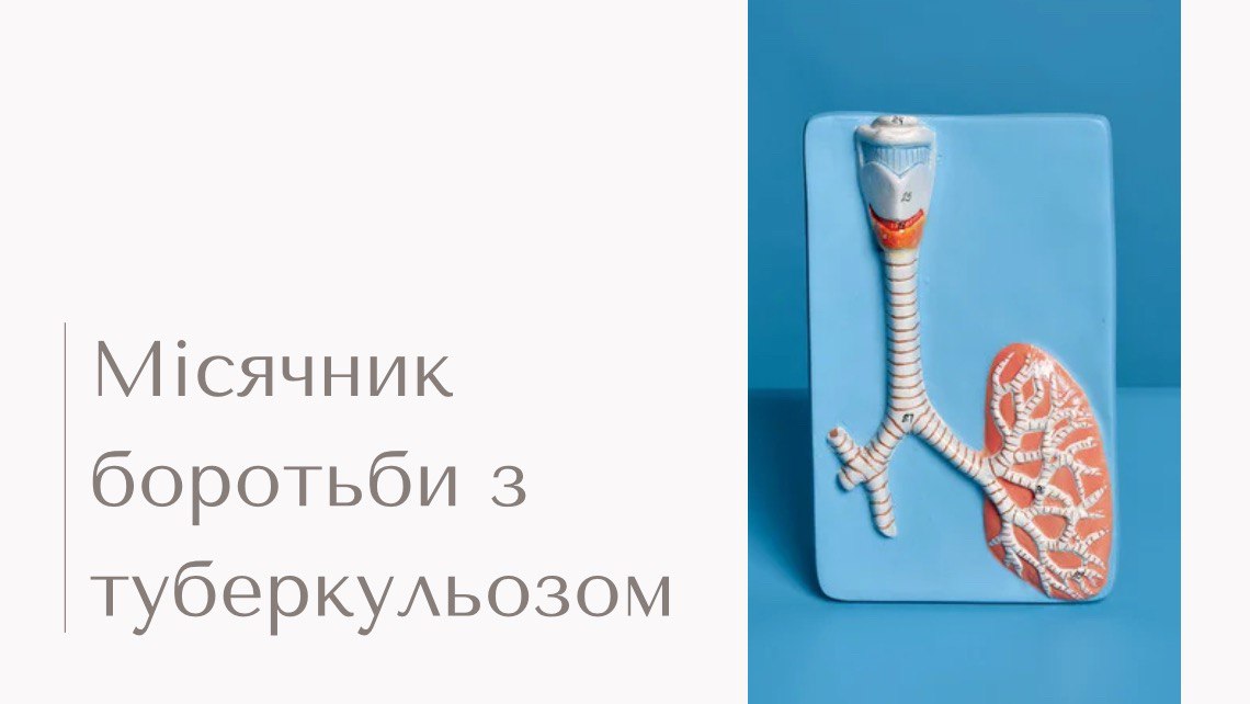                    Здолаємо туберкульоз разом! – лікарі-епідеміологи Львівського районного відділу ДУ «Львівський ОЦКПХ МОЗ»